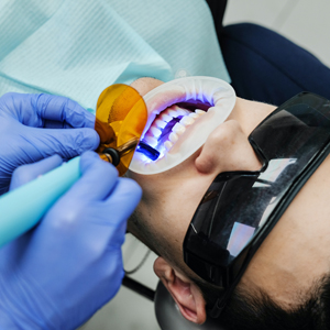 Procedure of Professional Teeth Whitening | Hudson | Niles