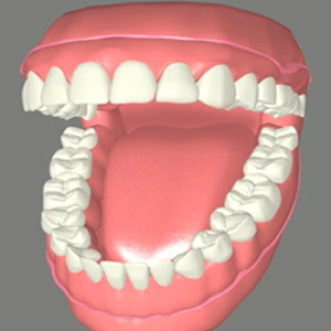  Dentures Near Me Liberty Township, Youngstown, Austintown, Girard, Hubbard, Niles, Hudson OH